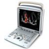 Chison Q6 Portable Ultrasound System