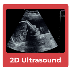 2d-ultrasound-compare