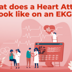 main-graphic-heart-attack-on-EKG